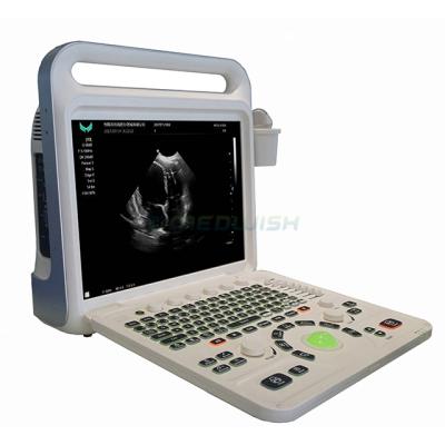 China AG-MYXF-E60 China Hospital Reasonable Price Universal Gynecology Examination Digital Portable Full Color Doppler for sale