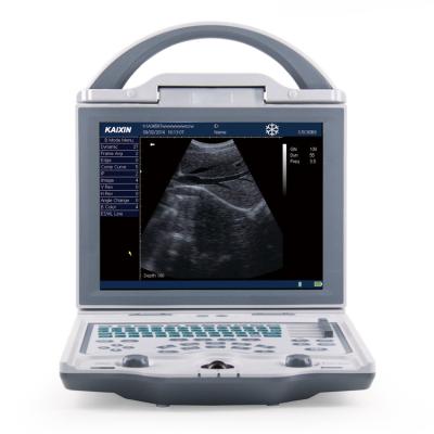 Cina Modo completo di Digital B di ultrasuono della macchina KX5600 della macchina medica diagnostica di ultrasuono in vendita