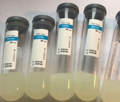 China PRP Gel Trinder Reagent For Facial Skin Rich In High Concentration Platelets for sale