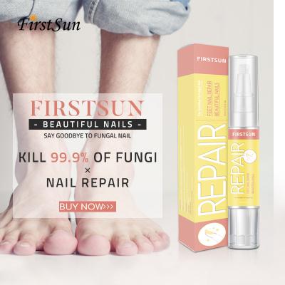 Китай Glyceryl Nail Repair Essence Anti Fungal Nail Fungus Pen продается