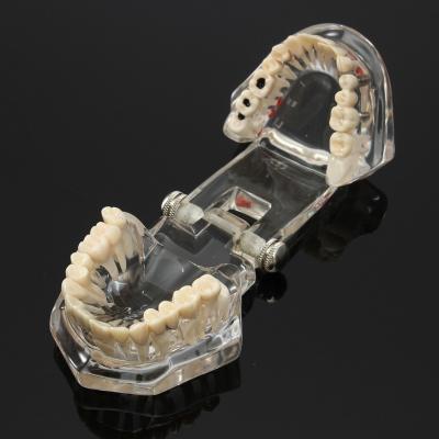 China Teaching Soft Gum Anatomy Dental Skull Model for sale