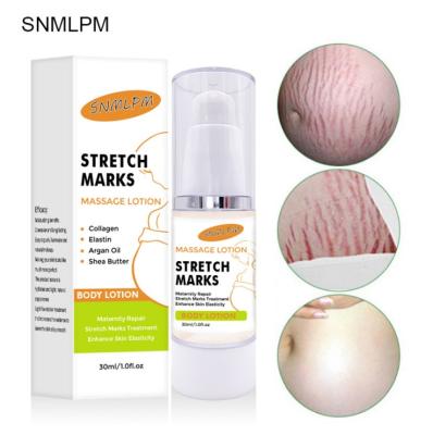 China Fading Pregnancy Stretches Pregnancy Stretch Mark Removal Cream Oil Private Label for sale