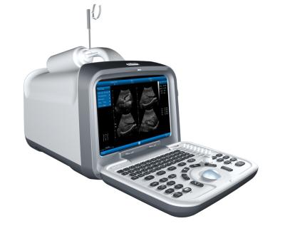 China Metal Good Prices Portable Ultrasound Machines For Clinic Hospital Use B/W Ultrasound Scanner for sale