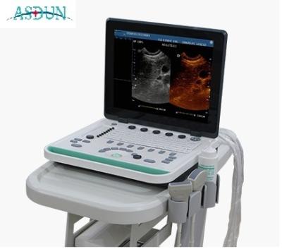 China High Quality Portable 3D Image Function Asdun Ultrasound Machine Echo Machine Medical Ultrasound Scanning Instruments for sale