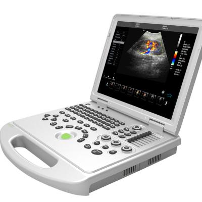 China Portable Metal Notebook Color Doppler Echo Scanner Machine Medical Color Ultrasound Machine For Sale for sale