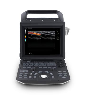 China Various Good Quality Full Digital Color Doppler Plastic System Ultrasound Portable Doppler Scanner Echo Ultrasound for sale