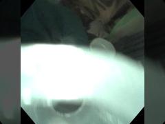 Tracheal Collapse & Bronchoscopic Anatomy