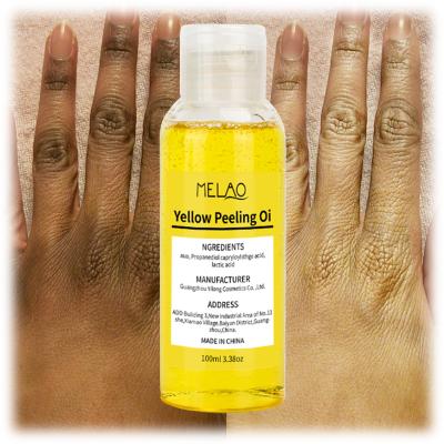 China MELAO Anti Wrinkle Anti Wrinkle Custom Dark Body Peel Logo Knuckles Lighten Oil Foot Hand Oil Strong Peeling Chemical OEM for sale