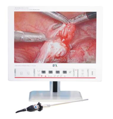 China Waterproof/Waterproof Hottest Integrated Endoscopy Camera System for Gynecology with HD Camera for sale