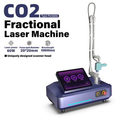 Cina 60W di qualità infrarosso Aming Stretch Removal Fractional CO2 Laser Beauty Machine in vendita