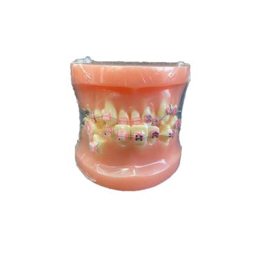 China LYU11017 School Ortho Metal And Ceramic Educational Teeth Model for sale