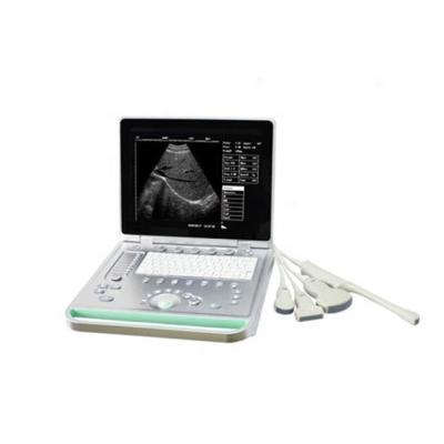 China 2021 Ultrasound cavitation machine 2 prob 3d 4d 5d color doppler ultrasound machine laptop plastic portable ultrasound scanner for sale