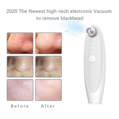 China Acne treatment blackhead_ remover_ remover_ blackhead_remover_tool for sale