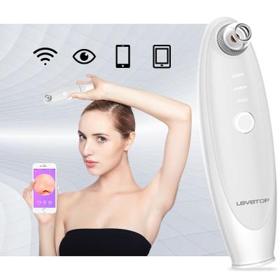 China Acne Treatment USB Rechargeable Blackhead Remover Brush Vacuum Blackhead Remover Visual for sale