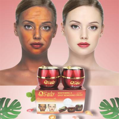 China Anti Aging Day and Night Cream Set 2 in 1 Collagen and Glutathio Remove Pimples Acne Spot Whitening Face Cream Private Label for sale