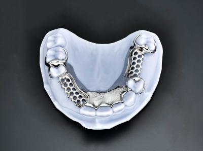 China Cuadro de metal ligero parcial de cobalto cromo Cuadro de metal dental en venta