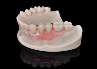 Chine Dentures flexibles hypoallergéniques durables et confortables à vendre