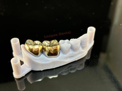 China Investing And Casting Full Metal Crown Biocompatibility Metal Crown Tooth for sale