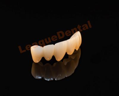 Cina Corone di laboratorio dentale 3D Pro Full Zirconia Corona e ponte Alta traslucidità in vendita