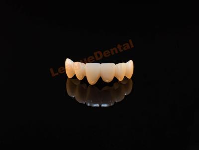 Cina Corone di zirconia naturale a pieno contorno Dental ad alta resistenza in vendita