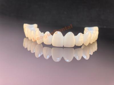 China Medische kwaliteit Zirconia-tandbrug Duurzame en esthetische Zirconia-bruggen Te koop