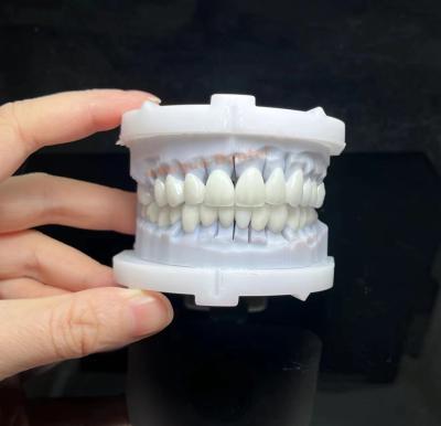 China Natuurlijke porselein gesmolten met zirconia doorzichtige PFZ brug en kroon Te koop