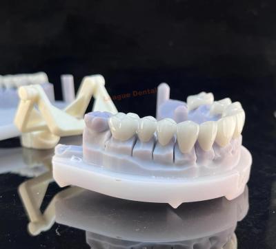 China Precise Fit Porcelain Zirconia Bridge Natural PFZ Crown High Strength for sale