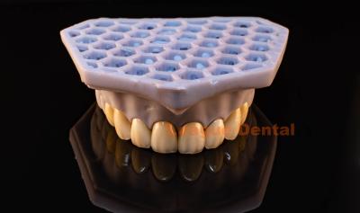 China Dental Enhancements PFZ Crowns CAD/CAM 0.3mm E.MAX Veneer Natural for sale