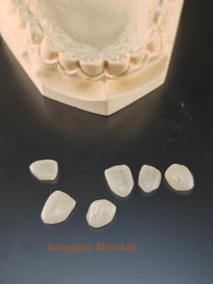 China Anweisungen Einlagerung Veneer Fleckenbeständigkeit E.MAX Veneer CAD/CAM Drücken und Schichten zu verkaufen