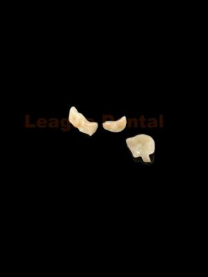 China Esthetic Zirconia Onlay Natural Looking Restoration Dental Onlay for sale