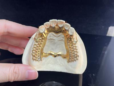 China Diseño del marco de la dentadura parcial natural en venta