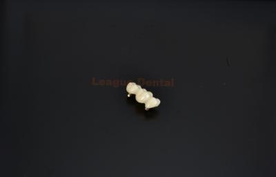 China Glazed Cement Retained Implant Crown High Strength Implant Cemented Crown for sale