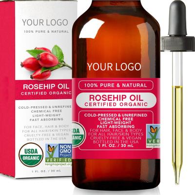 China Skin Revitalizer HIGHEST LEVELS FOR FACE HAIR COLD PRESSED UNREFINED PREMIUM 100% PURE NATURAL ORGANIC ROSEHIP OIL NON-GMO INGREDIENT ONLY ONE for sale