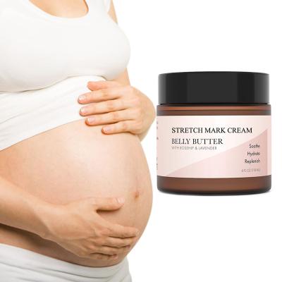 China Wholesale Private Label 100% Natural Maternity Skin Care Stretch Marks Removal Cream Anti Moisturizer for sale