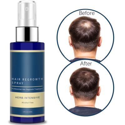 China 100% Natural Herbal Hair Loss Treatment Private Label Hair Loss Autumn Treatment Biotin Fast Effective Hair Growth Spray for sale