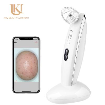 China Acne treatment factory hot sale skin pore vacuum facial blackhead remover with high quality for sale