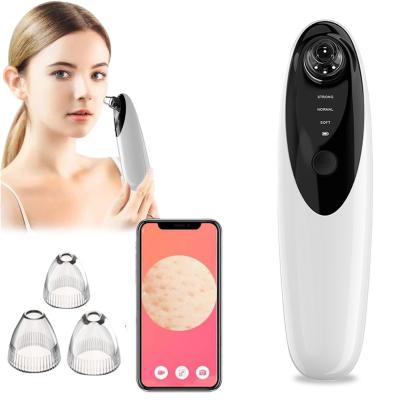 China Acne Treatment Blackhead Removal Vacuum Acne Treatment Vacuum Acne Professional Visual HD Blackhead Remover With Camera for sale