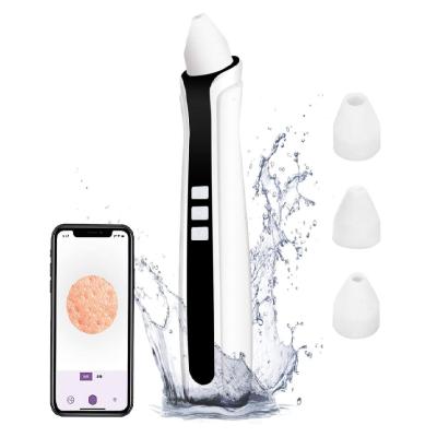 China Professional Rechargable Acne Facial Pore Extractor Strong Refillable wifi kit wifi blackhead remover vacuum cleaner vacuum with camera for sale