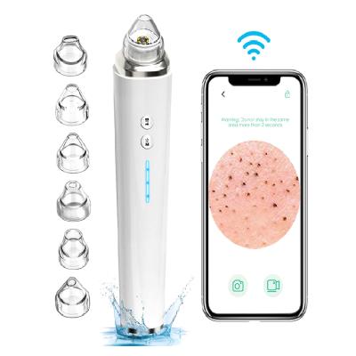 China Rechargeable Electric Acne Pore Vacuum Suction Remover Rechargeable USB Face Blackhead Remover Obvious Tool Kit With Wifi Camera for sale