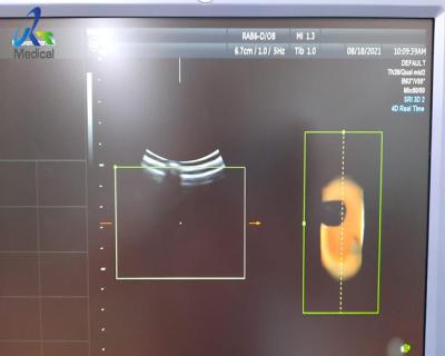 中国 気泡との3D超音波の調査修理GE RAB-6-Dのトランスデューサーの異常なイメージ 販売のため