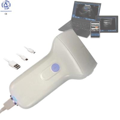 China Emergency Ultrasound Instrument Medical Ultrasound Probe Covers Wireless iPhone PC Android Ultrasound Probe for sale