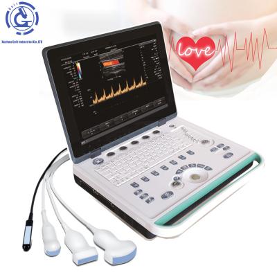 중국 Portable OB Ultrasound Machines Sonoscape S9 Doppler Ultrasound Scanner 판매용