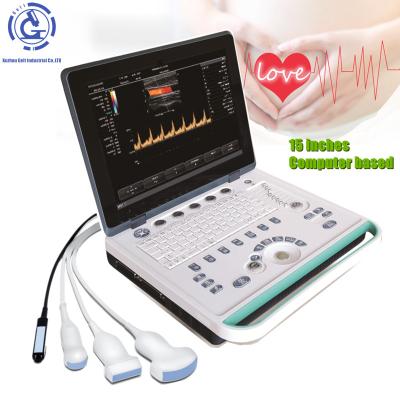 중국 Cheapest discount price laptop 3D OB GYN portatil ultrasonido digital ecografo OB portable ultrasound machine 판매용