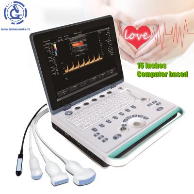 중국 OB China Manufacture Mobile Color Doppler Ultrasound With Best Price 판매용