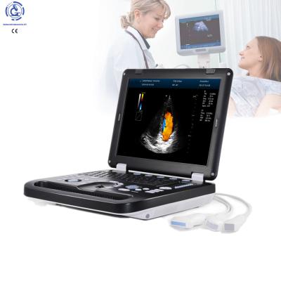 China Medical Portable OB Echo Laptop Vascular Hospital Doppler 3d 4d Color Doppler Ultrasound Price for sale