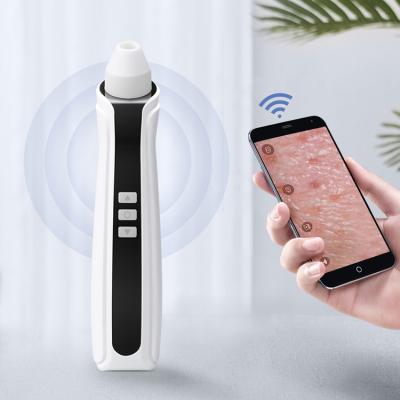 China Powerful Acne Treatment Blackhead Acne Blackhead Pore Skin Dirt Remover Tool Portable Handheld Electric Obvious Vacuum Powerful for sale