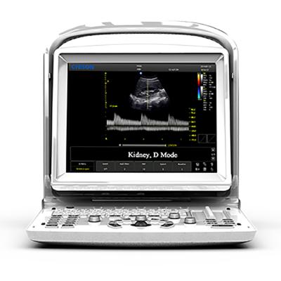 China Eco3 portable obstetrics and gynecology ultrasound machine, buy ultrasound scanner, ultrasound scanner price for sale