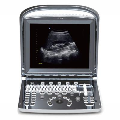 China Digital 3d 4d Obstetrics and Gynecology Portable Medical Color Doppler ECO 1 Trolley Ultrasound Machine Price for sale