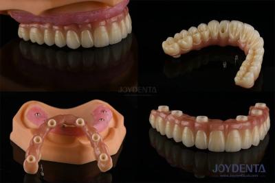 China Ivoclar Implant Ball Attachments Removable Dental Implant Material For Oral Hygiene for sale