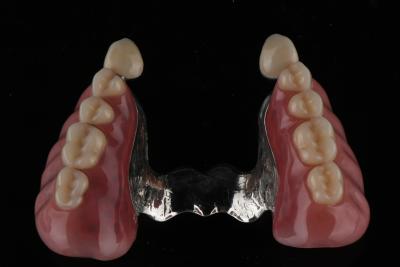 Chine Résistant à l'odeur des taches Prothèse dentaire en acrylique complète Dentition dentaire en résine acrylique naturelle à vendre